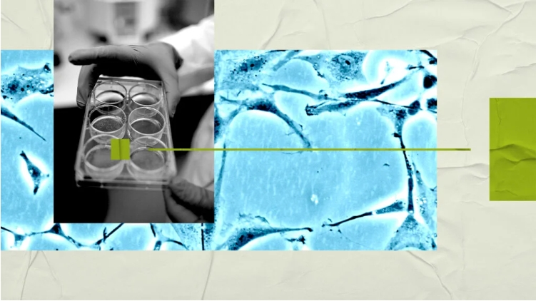 研究人員稱，大腦研究可能有助于開發(fā)新的精神分裂癥治療方法。