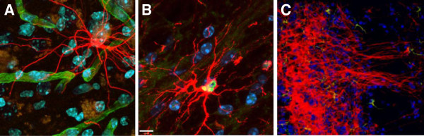 圖3：人類中樞神經(jīng)系統(tǒng)干細(xì)胞 (HuCNS-SC) 根據(jù)其遷移位點(diǎn)優(yōu)先分化為特定譜系。