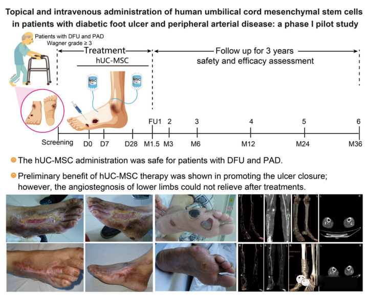 探索干細(xì)胞對(duì)糖尿病足愈合的療效和機(jī)制。