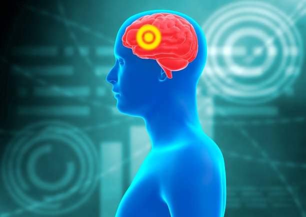 中風(fēng)患者的康復(fù)策略有哪些？