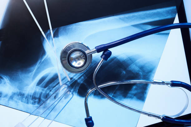 干細(xì)胞治療在風(fēng)濕病中的作用 干細(xì)胞治療在風(fēng)濕病中的作用