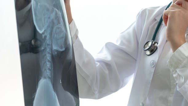 4種可行的治療強直性脊柱炎發(fā)方法，你都了解嗎？