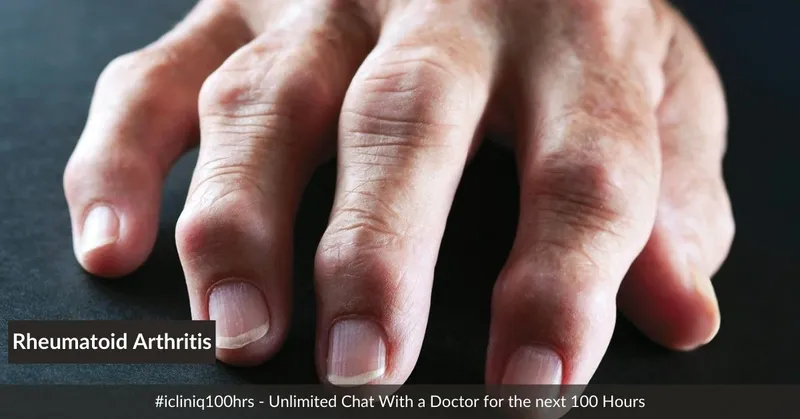 類風(fēng)濕關(guān)節(jié)炎的體征和癥狀是什么？及其治療方法