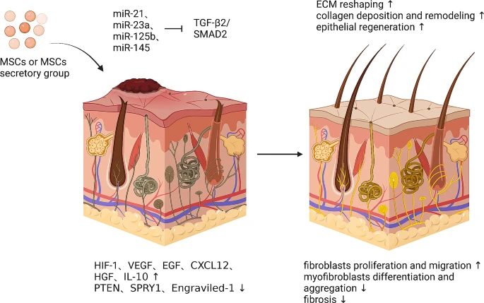 圖6：間充質(zhì)干細胞促進皮膚疤痕修復(fù)的機制。