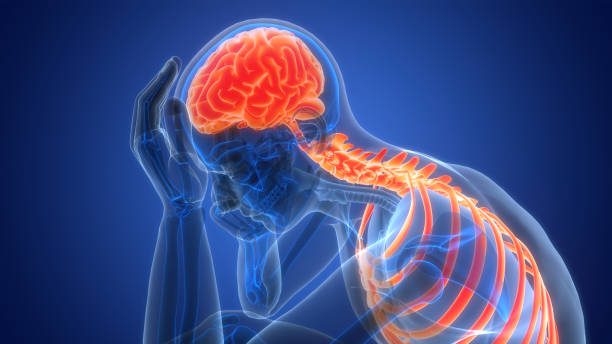 什么是缺血性腦中風(fēng)，癥狀、原因、診斷和治療