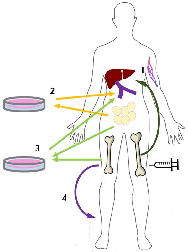 圖1：間充質(zhì)干細胞治療1型糖尿病方法示意圖。