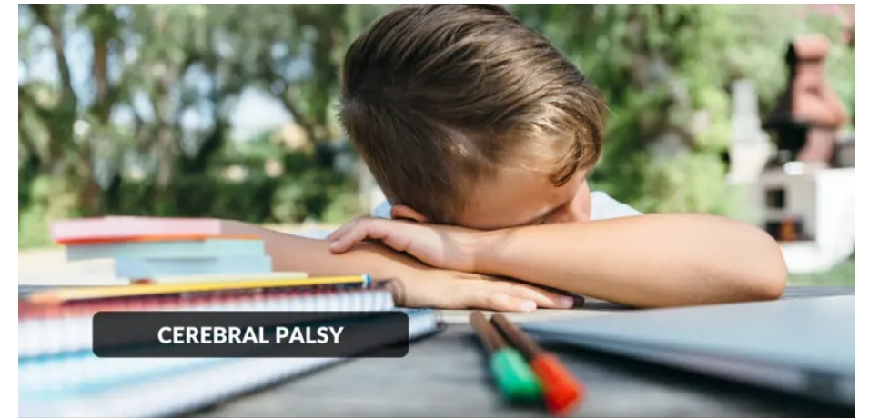 腦癱-原因、癥狀、類型和治療方法