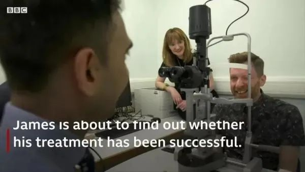 干細(xì)胞治療燒傷失明臨床案例 干細(xì)胞治療燒傷失明臨床案例