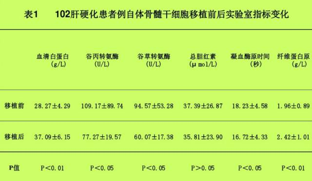 自體骨髓干細(xì)胞移植治療肝硬化102例報(bào)告。