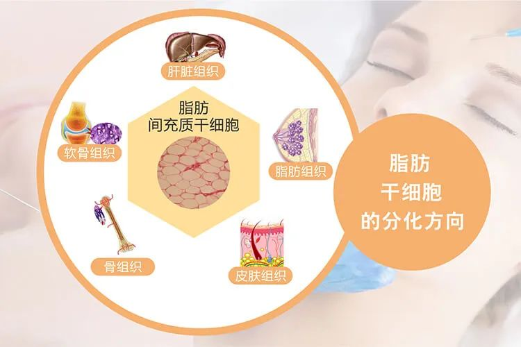 什么是脂肪干細(xì)胞：脂肪干細(xì)胞來源、臨床應(yīng)用