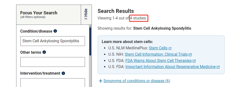 干細(xì)胞治療強直性脊柱炎臨床研究項目有4項