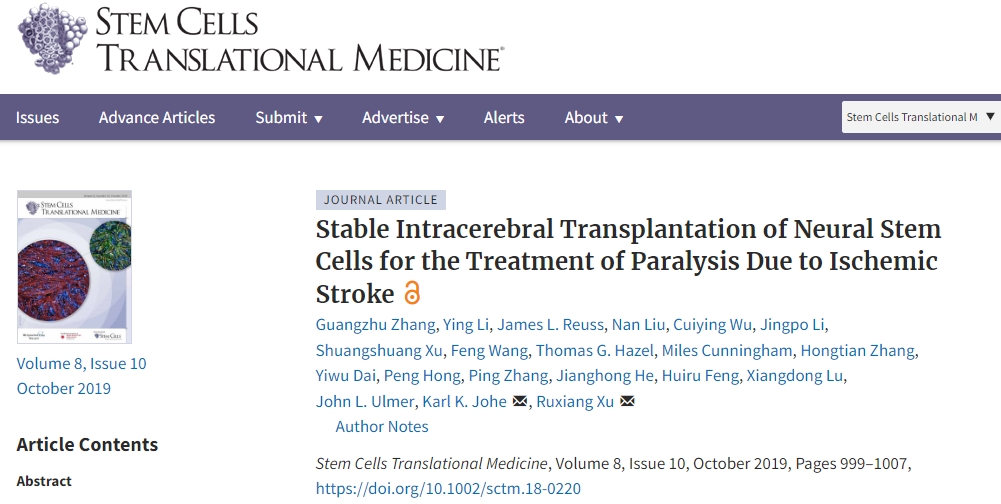 解放軍總醫(yī)院：神經(jīng)干細(xì)胞移植治療缺血性中風(fēng)，臨床表明效果良好！