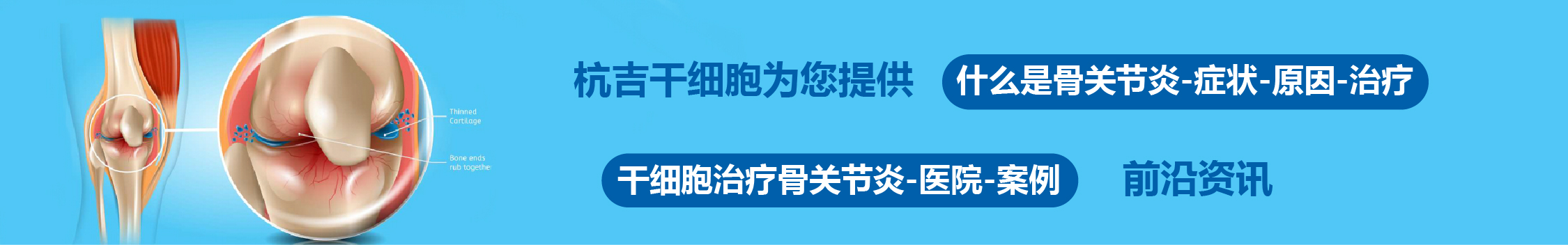 國內外干細胞醫(yī)院治療骨關節(jié)炎的臨床案例
