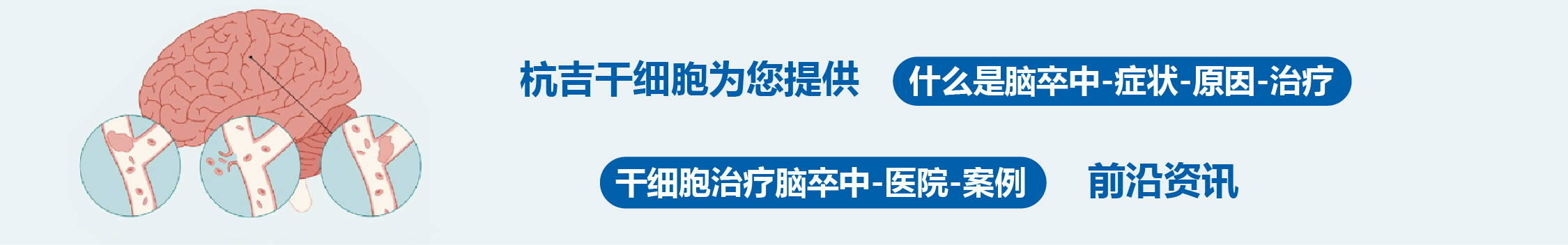 國內(nèi)外干細(xì)胞醫(yī)院治療腦卒中的臨床案例