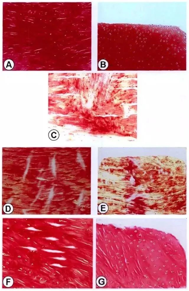 不同時間點修復組織紅-紅區(qū)與白-白區(qū)II型膠原表達量
