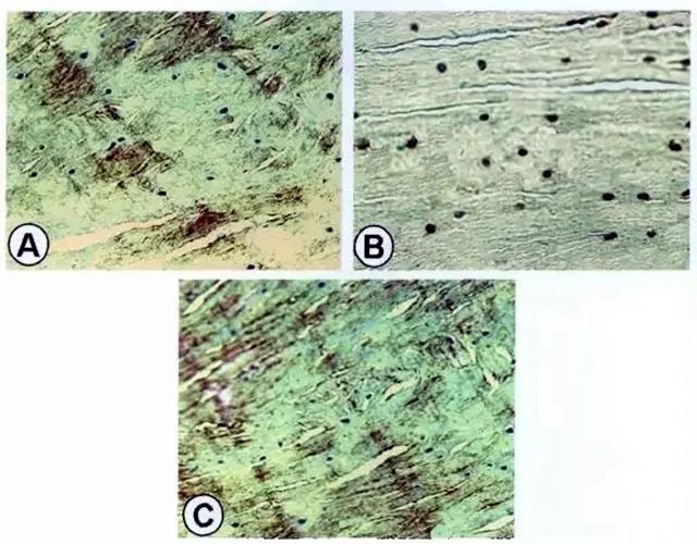 A為紅-紅區(qū)修復組織II型膠原的表達；B為紅-紅區(qū)修復組織S-100蛋白表達；C為紅-紅區(qū)修復組織I型膠原表達。