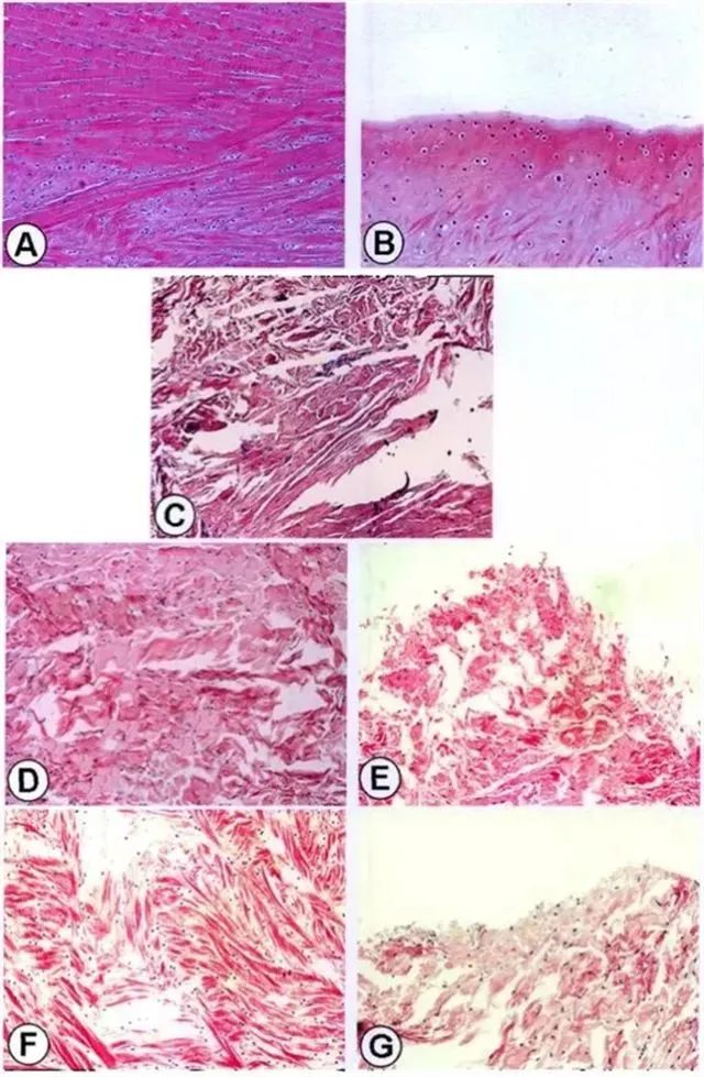 不同時間點修復組織紅-紅區(qū)與白-白區(qū)II型膠原表達量
