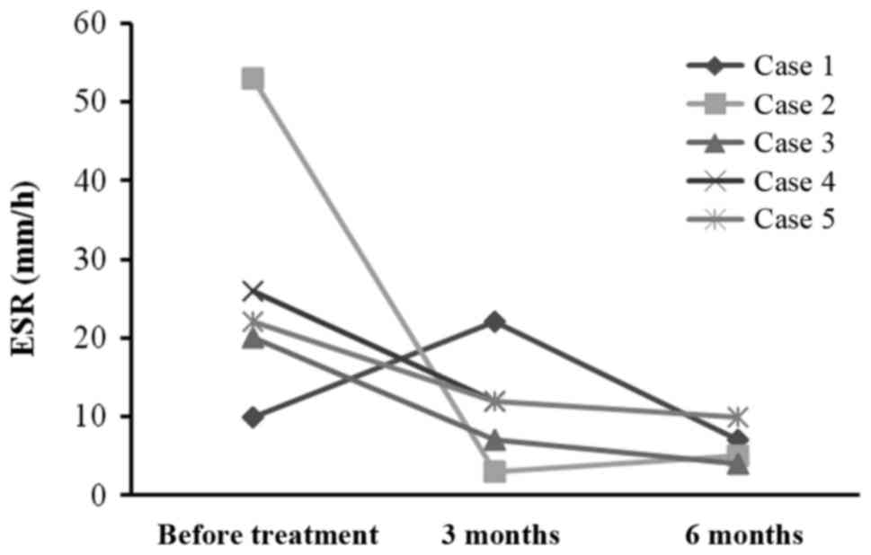 每位患者治療前后的 CRP 水平。1 名患者的 CRP 水平降低，而其他 4 名患者的 CRP 水平保持穩(wěn)定并在正常范圍內(nèi)。CRP，C 反應蛋白。