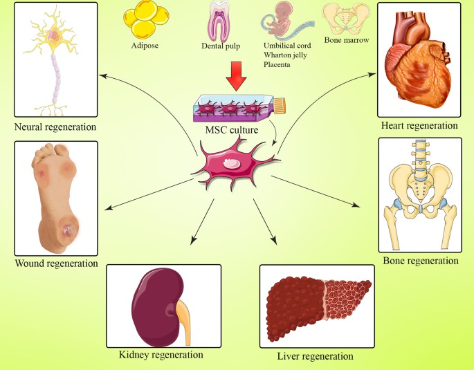 間充質(zhì)干細(xì)胞(MSC) 是一種多能細(xì)胞，可分化為基質(zhì)譜系細(xì)胞。間充質(zhì)干細(xì)胞(MSC) 是骨髓 (BM-MSC)、脂肪組織、肝臟、羊水、胚胎胎盤、臍帶血和其他組織中的一組非造血細(xì)胞。骨髓間充質(zhì)干細(xì)胞能夠抑制與GVHD病理生理學(xué)有關(guān)的大多數(shù)免疫細(xì)胞的激活和功能。