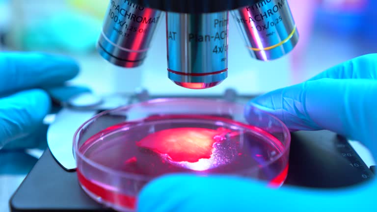 間充質(zhì)干細(xì)胞療法的利與弊 間充質(zhì)干細(xì)胞療法的利與弊