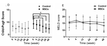 人臍帶間充質(zhì)干細(xì)胞（hUC-MSC）治療對(duì)肝硬化失代償期腹水患者腎功能、凝血功能及Child-Pugh和MELD評(píng)分的影響