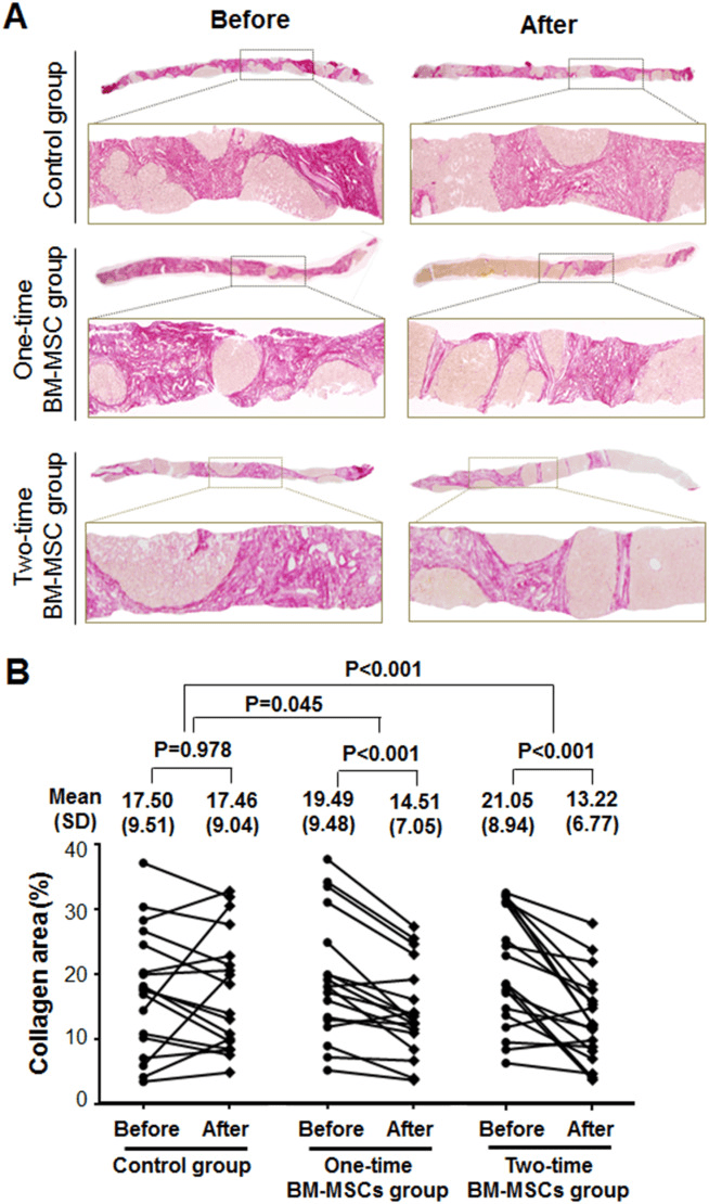 膠原蛋白面積的定量組織學(xué)分析。