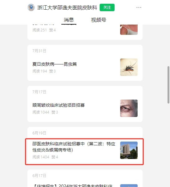干細胞臨床招募：邵逸夫醫(yī)院招募特應(yīng)性皮炎濕診患者參與治療！