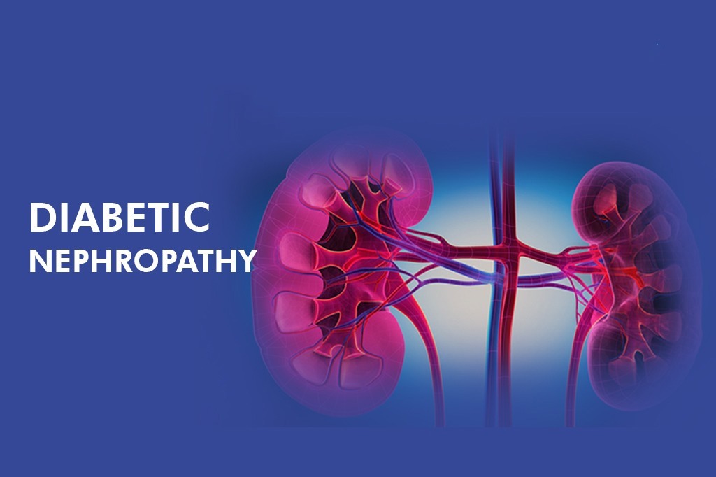 干細(xì)胞治療糖尿病腎病患者16例，能夠有效控制血糖，改善腎功能