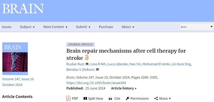 確認(rèn)干細(xì)胞治療中風(fēng)后的大腦修復(fù)機(jī)制，以推動(dòng)干細(xì)胞治療中風(fēng)進(jìn)入臨床至關(guān)重要！
