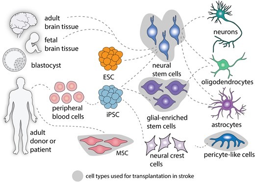 圖2：中風(fēng)后細(xì)胞治療的細(xì)胞類型。