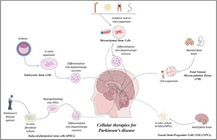 圖1：帕金森病的細胞療法：胚胎干細胞 (ESC)、誘導性多能干細胞 (iPSC)、間充質(zhì)干細胞 (MSC)、神經(jīng)干細胞/祖細胞 (NSC/NPS) 是帕金森病的新興候選藥物。