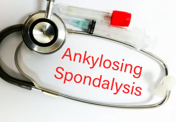 2019-2024年干細(xì)胞治療強直性脊柱炎臨床研究進展