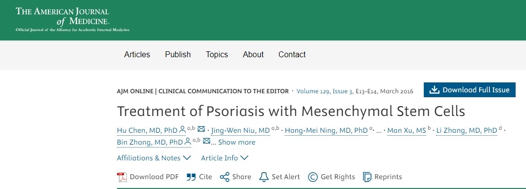 用間質(zhì)干細(xì)胞治療牛皮癬 用間質(zhì)干細(xì)胞治療牛皮癬