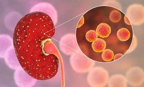 干細胞治療狼瘡性腎炎的安全性怎么樣？盤點國內(nèi)外臨床進展！