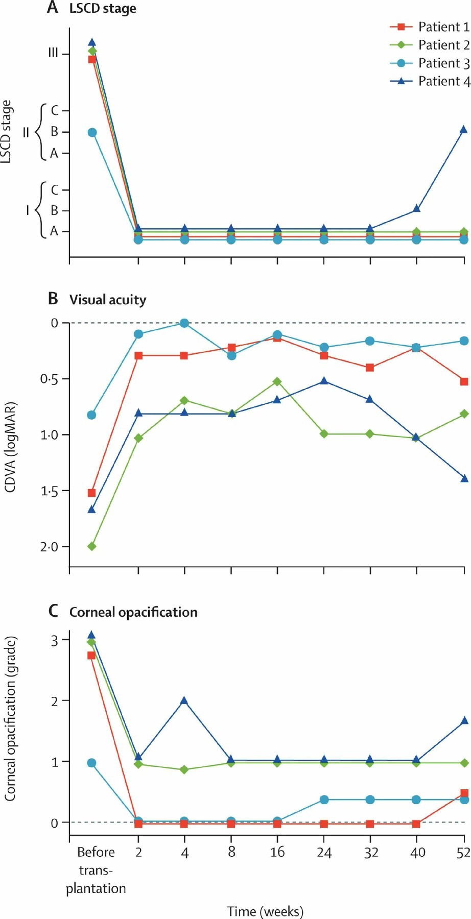 圖2：LSCD 分期、視力和角膜混濁