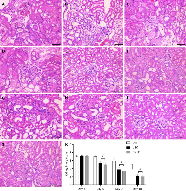 圖4：通過蘇木精和伊紅染色（200 ×）對(duì)尿液來源的干細(xì)胞治療、骨髓間充質(zhì)干細(xì)胞治療和對(duì)照未治療小鼠的急性腎損傷進(jìn)行組織學(xué)檢查。