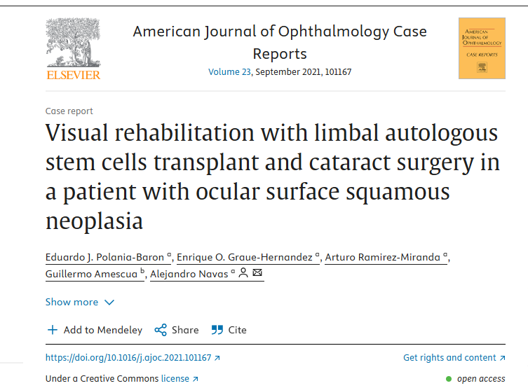 眼表鱗狀細胞瘤患者角膜緣自體干細胞移植及白內(nèi)障手術(shù)進行視力康復(fù)