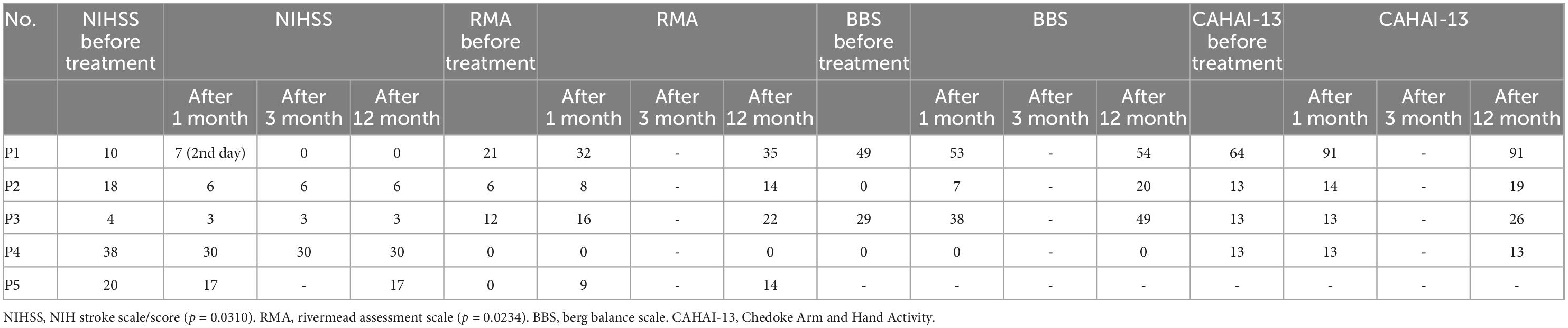 臍帶間充質(zhì)干細胞 (UC-MSC) 治療后中風康復的結(jié)果測量 臍帶間充質(zhì)干細胞 (UC-MSC) 治療后中風康復的結(jié)果測量