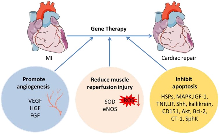 圖2：MI基因治療示意圖。
