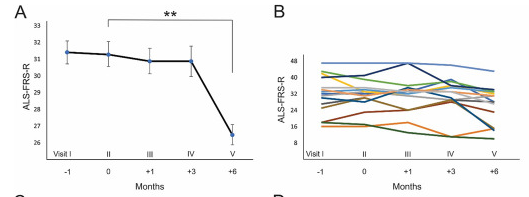 肌萎縮側(cè)索硬化癥 (ALS) 患者隨訪期間的臨床分析