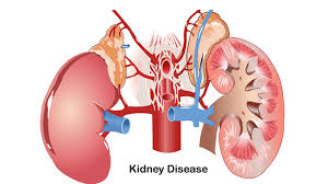 減輕負擔(dān),延長生命:干細胞療法對降低腎病透析并發(fā)癥的影響評估 減輕負擔(dān),延長生命:干細胞療法對降低腎病透析并發(fā)癥的影響評估
