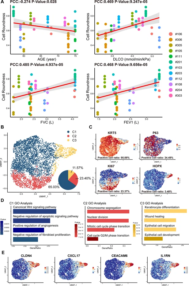 圖2：從IPF患者中分離的P63+肺祖細(xì)胞的細(xì)胞形態(tài)和單細(xì)胞RNA測序分析。
