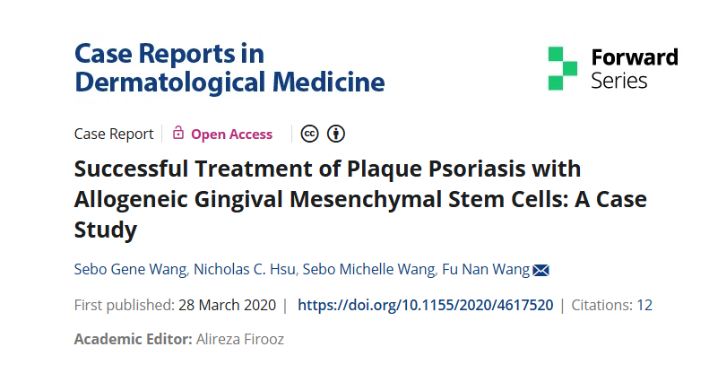 同種異體牙齦間充質(zhì)干細(xì)胞成功治療斑塊性銀屑?。喊咐芯? class=