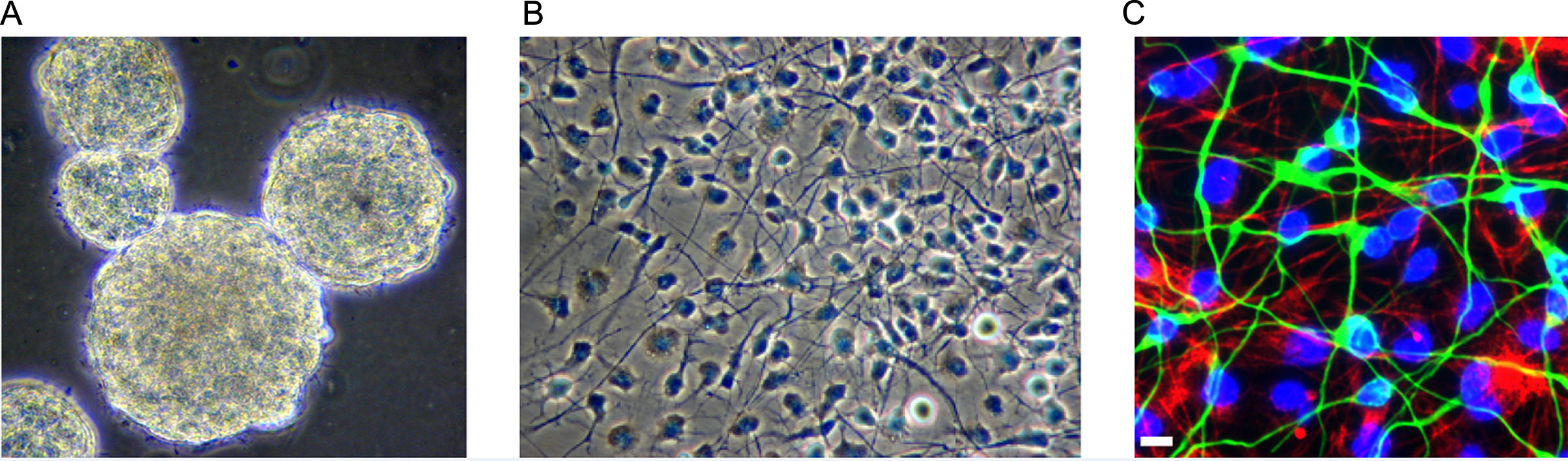 圖1：人類胎兒腦源性神經(jīng)干細(xì)胞。