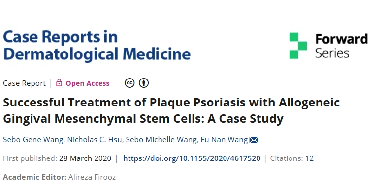 同種異體牙齦間充質(zhì)干細胞成功治療斑塊性銀屑病：案例研究