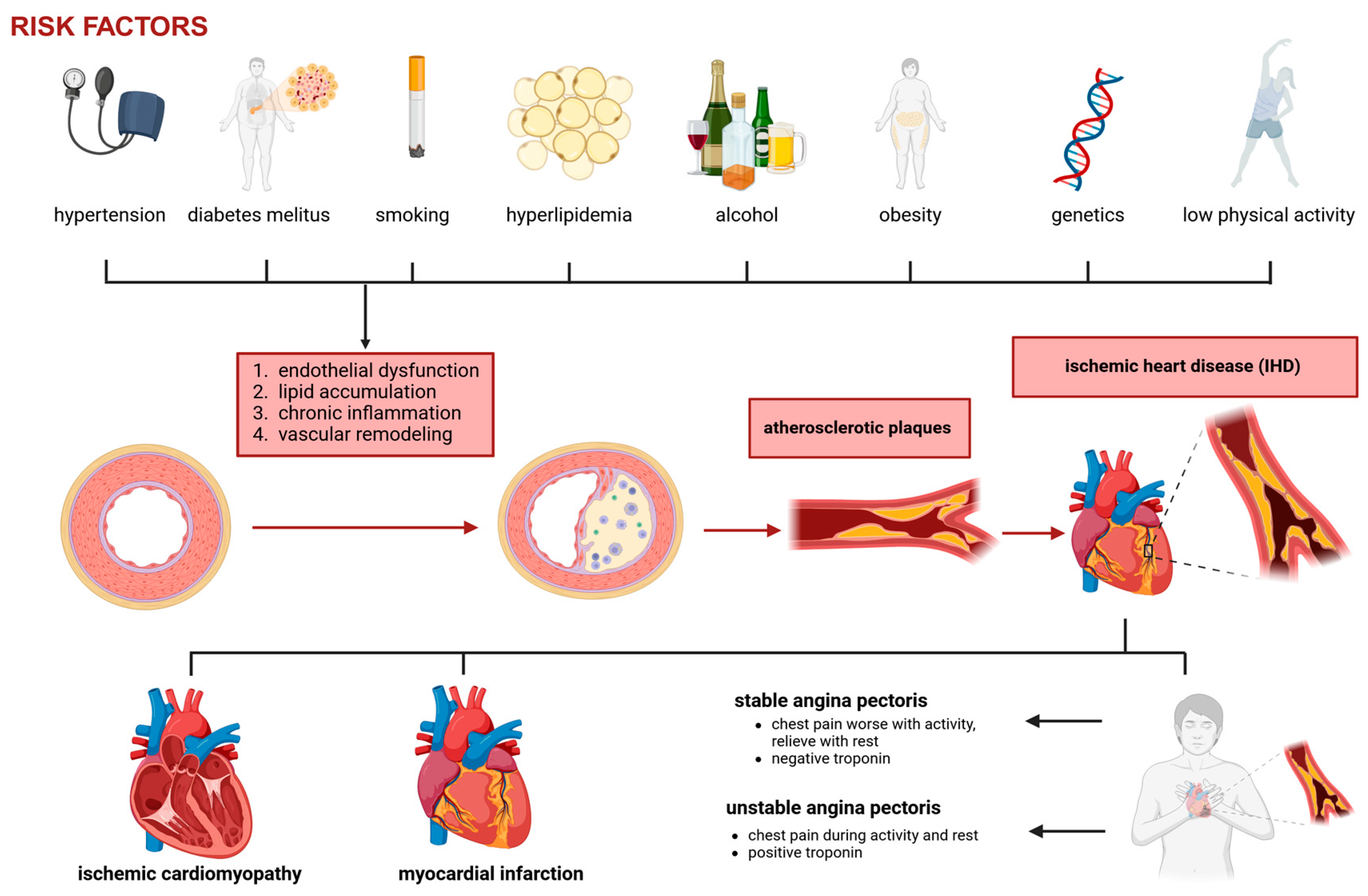 圖1：冠狀動(dòng)脈疾病和缺血性心臟病的病理生理學(xué)。