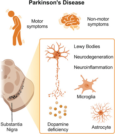 圖1:帕金森病的臨床和神經(jīng)病理學(xué)特征 圖1:帕金森病的臨床和神經(jīng)病理學(xué)特征