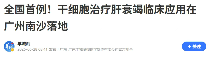 全國(guó)首例異體骨髓間充質(zhì)干細(xì)胞（MSC）治療慢加急性肝衰竭