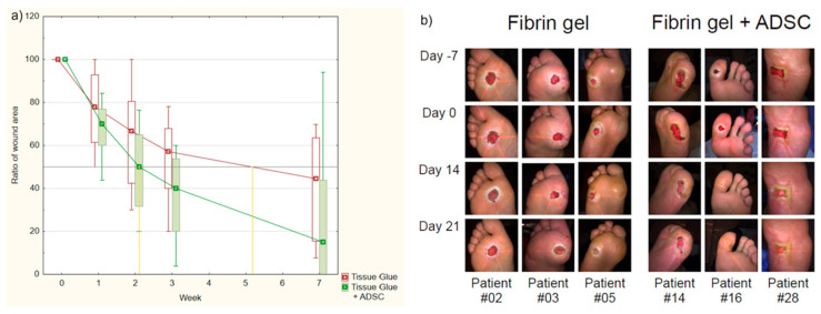 圖1：纖維蛋白凝膠組和AASC組患者治療進展對比。