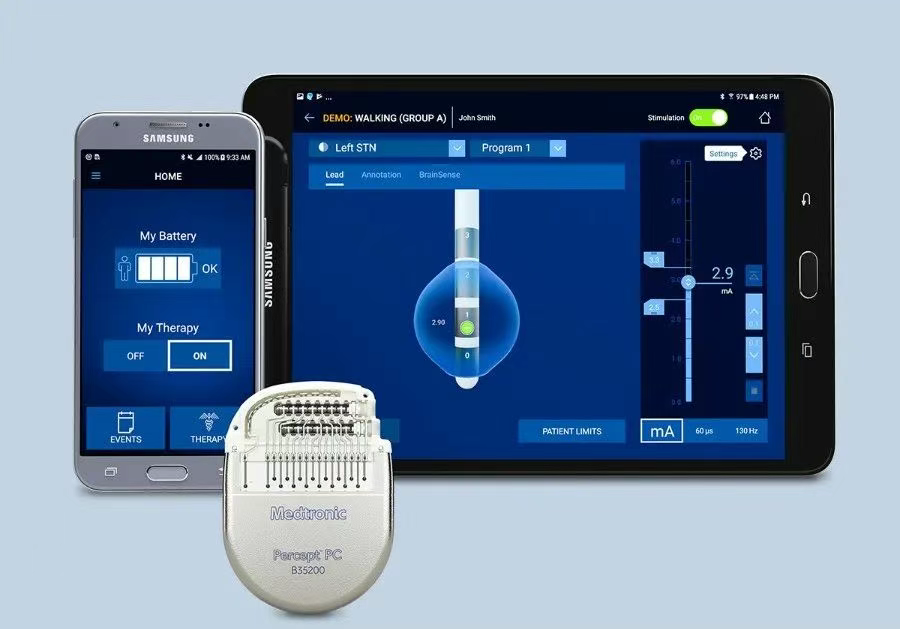 美敦力推出的BrainSense?自適應(yīng)腦深部刺激（aDBS）系統(tǒng)